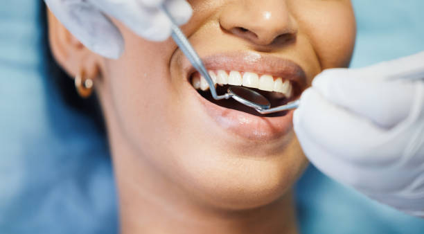 Best Emergency Treatment for Toothache in Placerville, CA