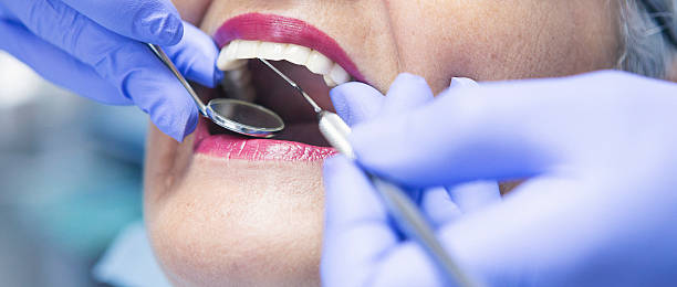 Best Walk-In Emergency Dentist in Placerville, CA